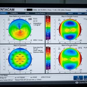 Pentacam (Tomografia de Córnea)