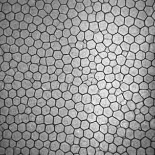Microscopia especular de córnea